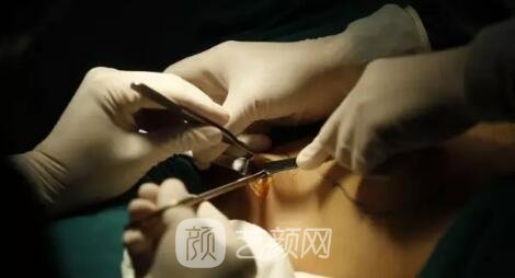 乳房的真相：隆胸的痛！