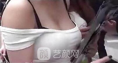 乳房的真相：隆胸的痛！