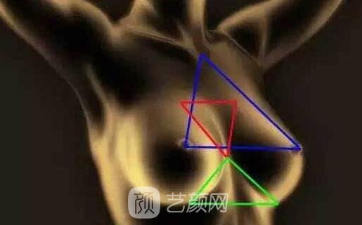 假體隆胸VS脂肪移植，何去何從？