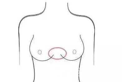 隆胸后，你會(huì)給你的胸部打多少分？