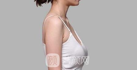 乳房下垂是誰的錯？應該如何拯救下垂的乳房？