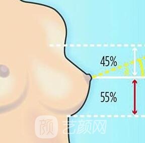 胸部下垂可分成哪幾種呢?