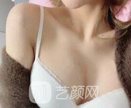 沒問題豐胸的方法有哪些？