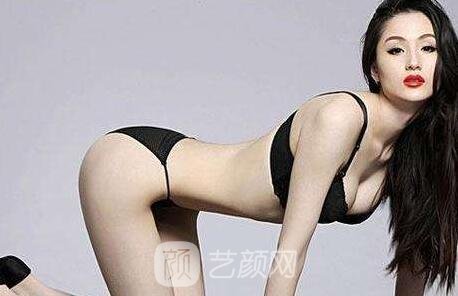 沒問題豐胸的方法有哪些？