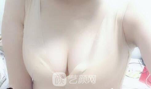 . 長結(jié)締?基本不太可能