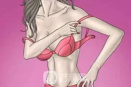 三種副乳必須手術調(diào)節(jié)!