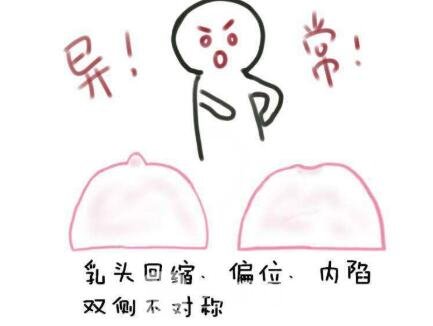 乳腺結節(jié)良性和惡性的區(qū)別