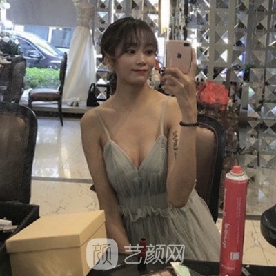 長(zhǎng)沙劉超峰醫(yī)生做鼻修復(fù)怎么樣？2022招牌案例公布