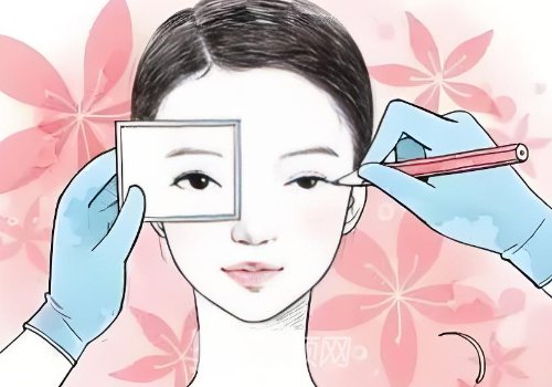 唐山做雙眼皮手術多少錢