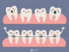 士卓曼種牙等級，分為三