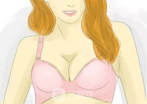 成都自體脂肪填胸價格貴