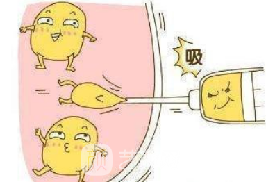 蘭州吸脂價格是多少?收費(fèi)