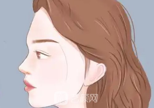 廈門做鼻子要多少錢?收費