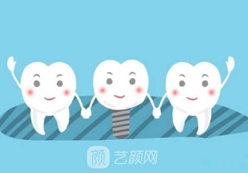 法國(guó)安卓健種植牙是什么