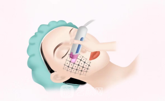 金達威聚拉美價格貴嗎?能