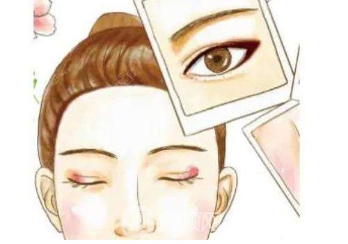 北京割雙眼皮多少錢知乎