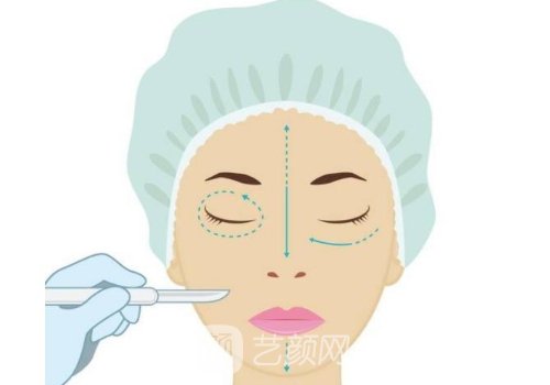 邁諾威溶脂針什么時(shí)候上