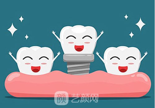 奧齒泰屬于哪個檔次?優(yōu)勢