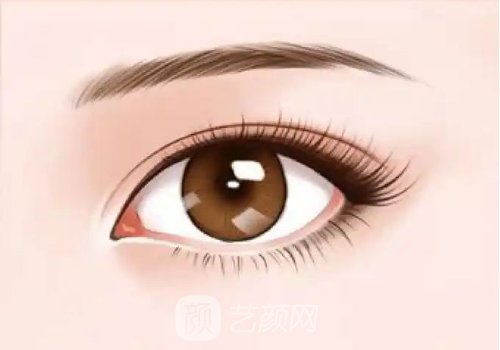 上海做雙眼皮到大概費用