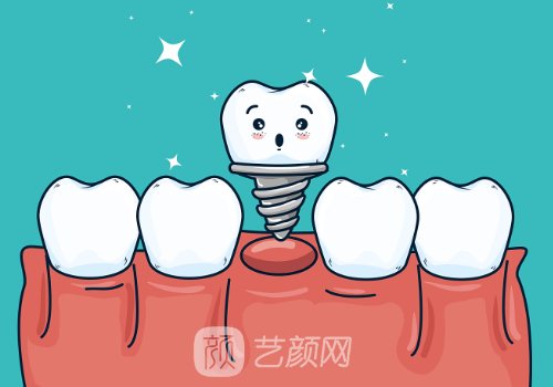 武漢2026年種植牙多少錢一