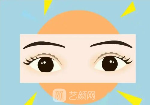 內(nèi)雙雙眼皮圖片案例分享