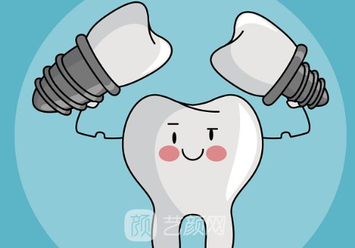 重慶種植牙要多少錢?幾千